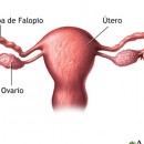ovario